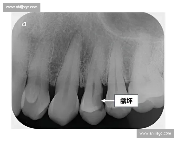 切斯特VS布拉德关键对决前瞻走势分析与胜负悬念解读全景观察